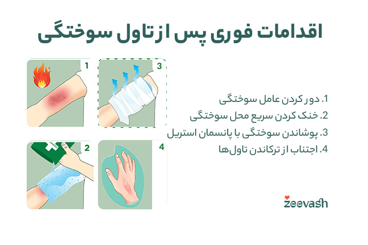 اقدامات فوری پس از تاول سوختگی